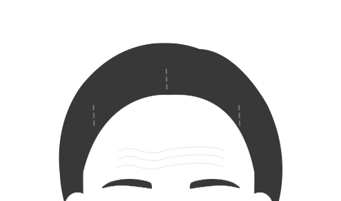 볼뉴머 STEP 01